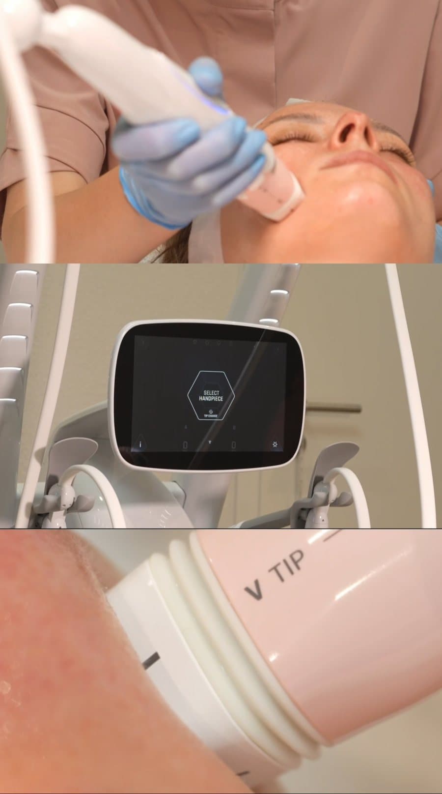 Split-screen beauty treatment film: handpiece on skin, device screen, V-tip close-up